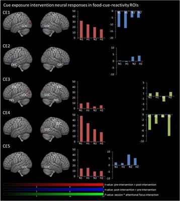 Neural Correlates of Food Cue Exposure Intervention for Obesity: A Case-Series Approach